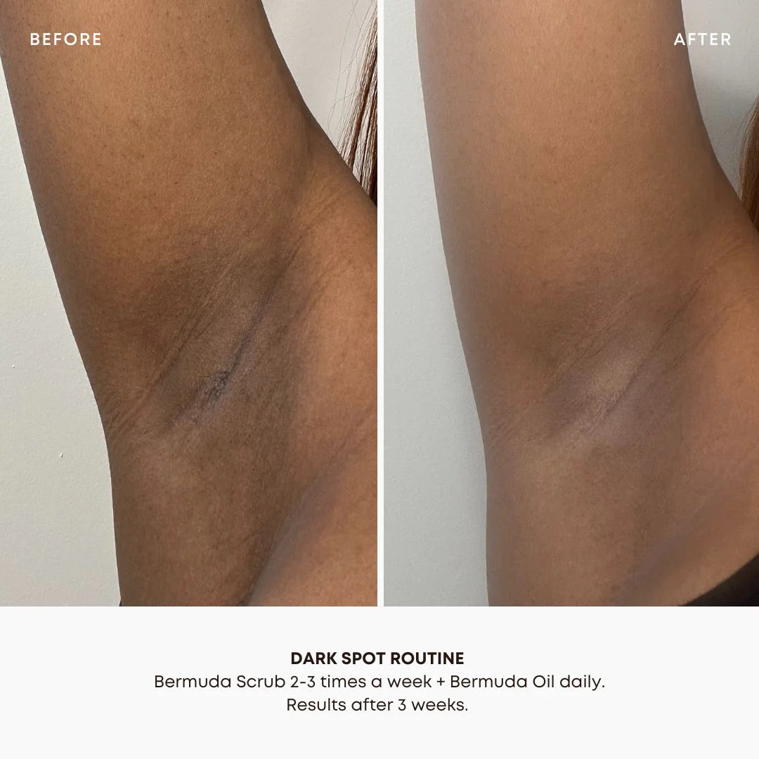 Dark Spot Treatment | 30ml